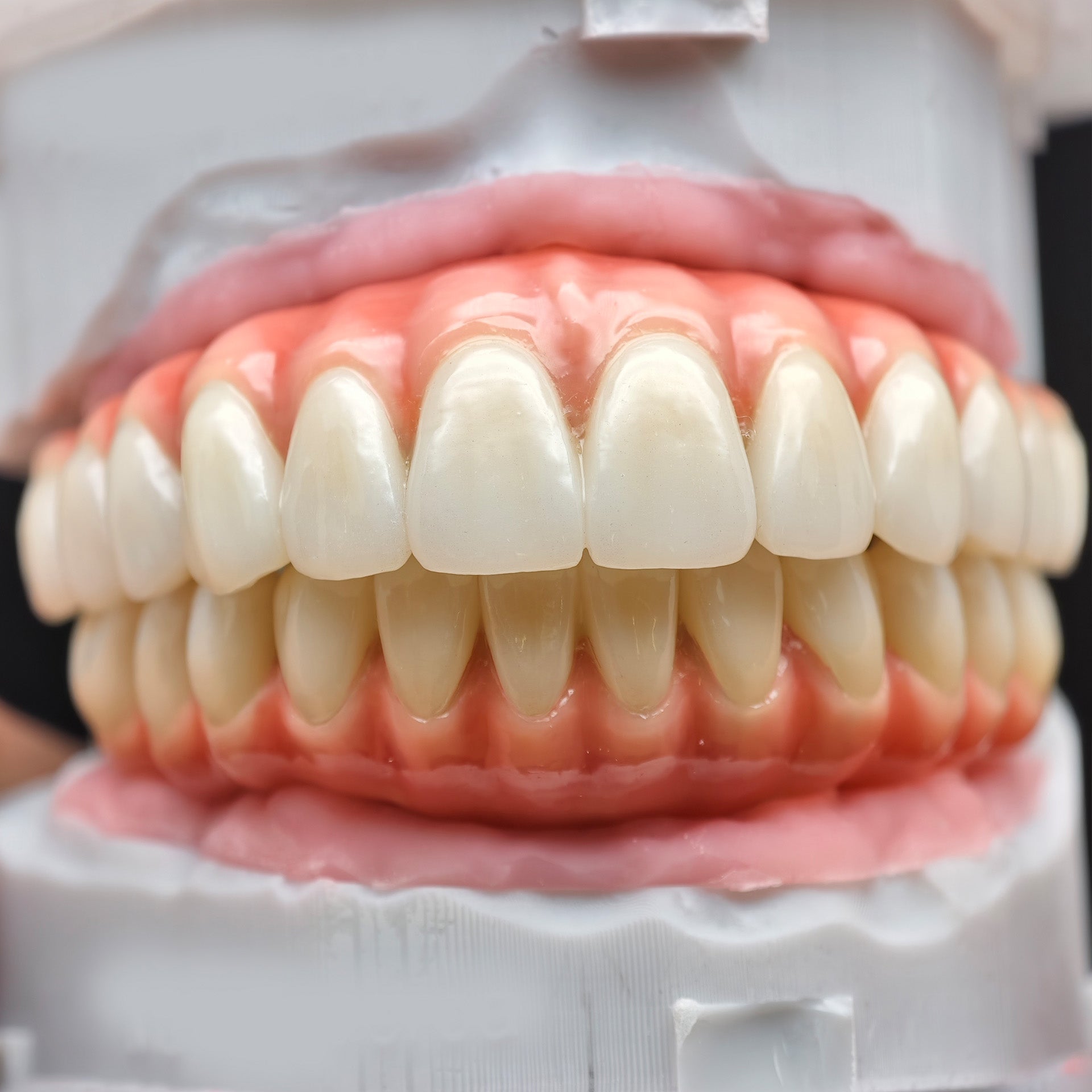 Enhanced Zirconia Crown Malo Bridge
