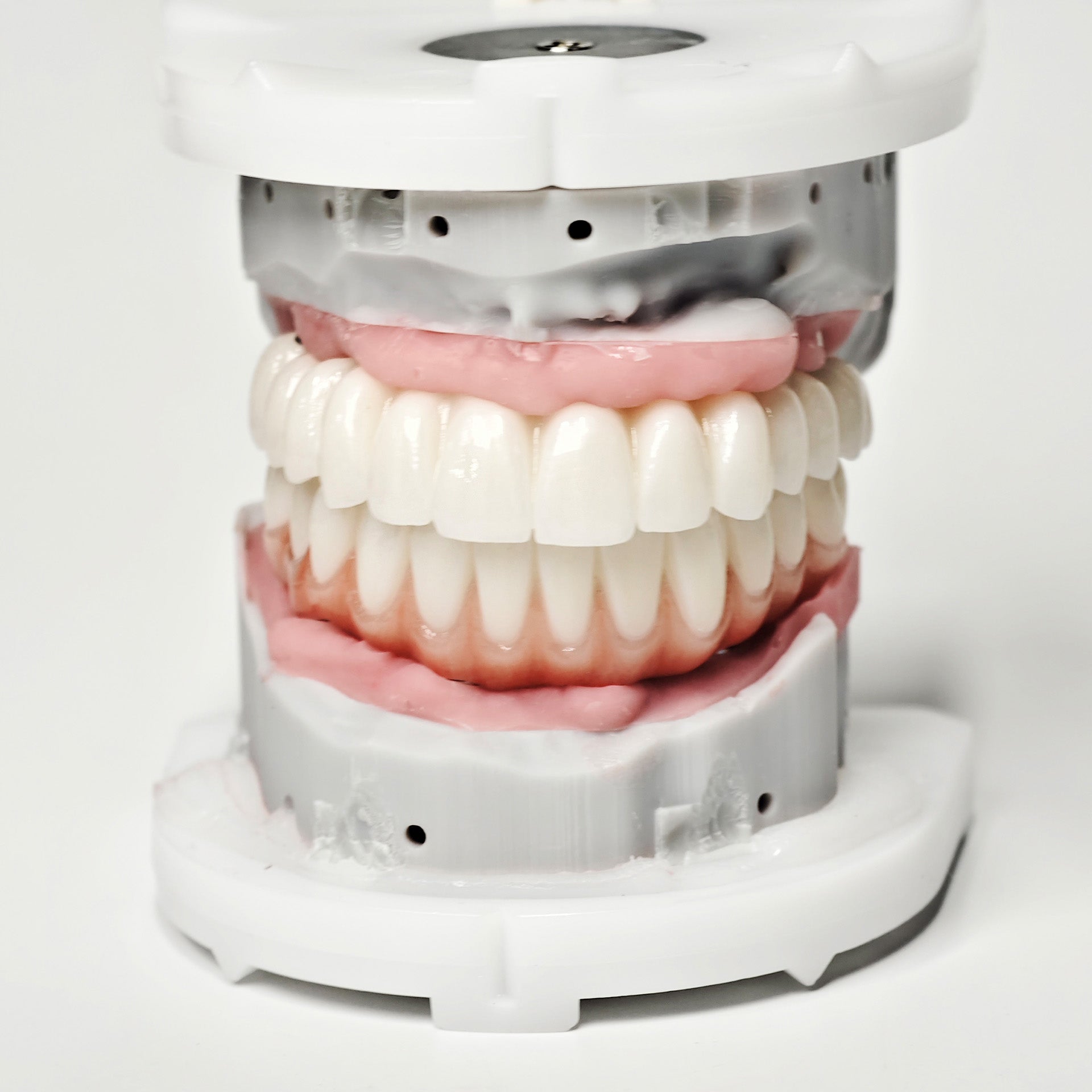 Full-Arch Zirconia Bridge With Ti-Base Abutment