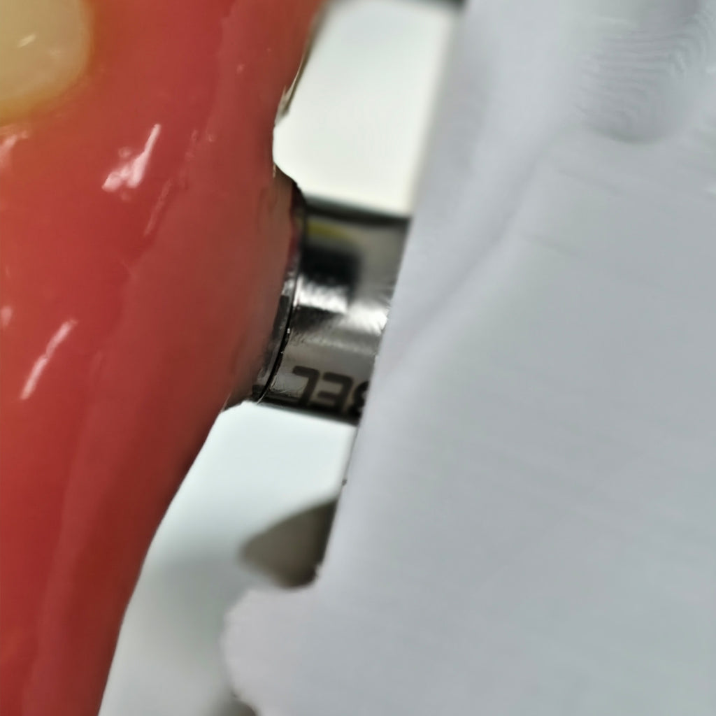 PMMA Bridge With Screw Retained