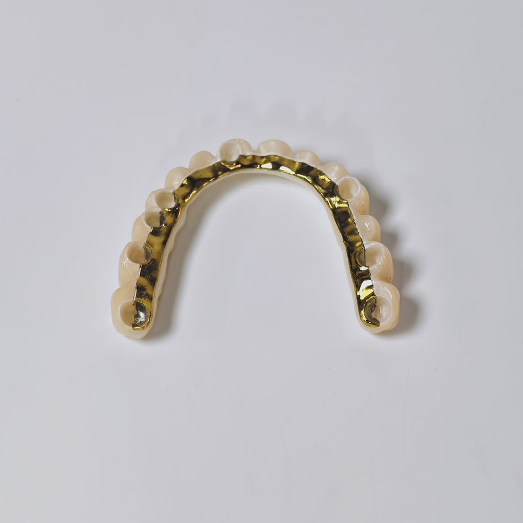 Ti-Bar Titanium Nitride Metal Frame With Zirconia Bridge And Cement Retained