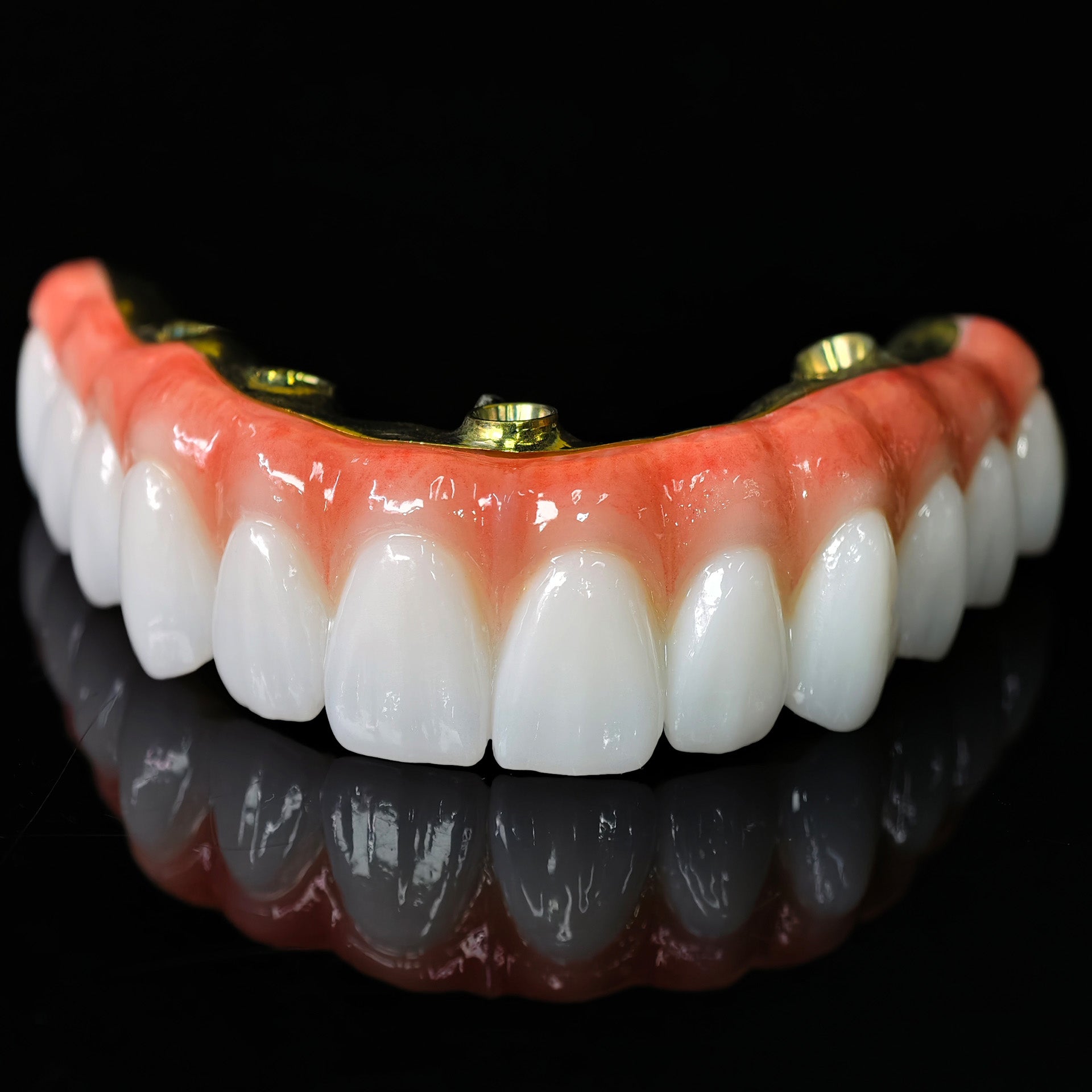 Ti-Bar Titanium Nitride Metal Frame With Zirconia Bridge For Full Arch Restoration