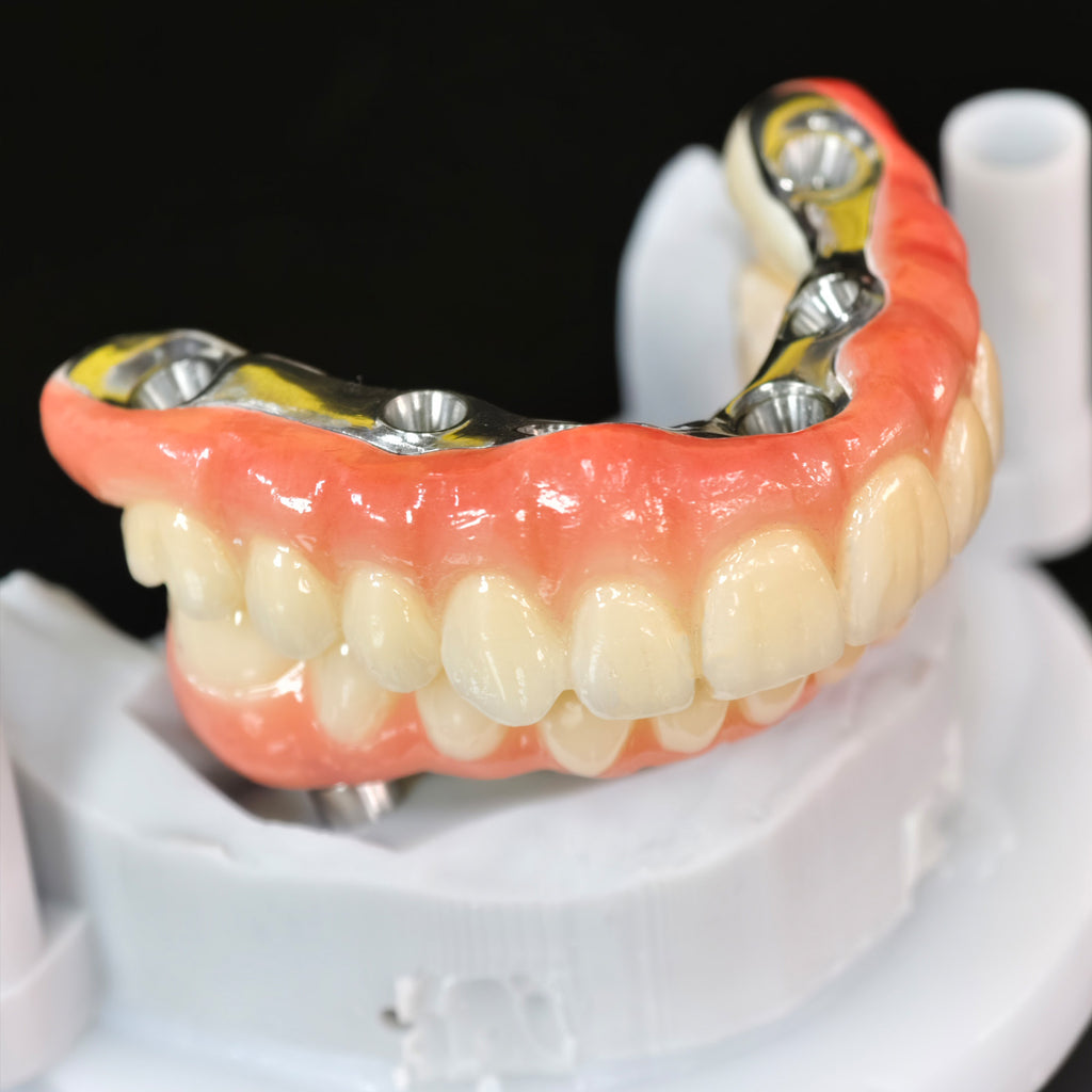Ti-Bar Titanium Nitride Metal Frame With Zirconia Bridge For Full Arch Restoration