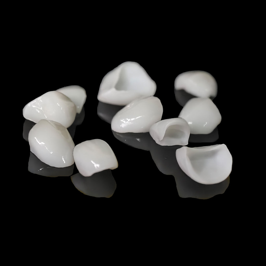Ultra-Thin Emax Veneer. High Transparency/Translucent, Natural Shade