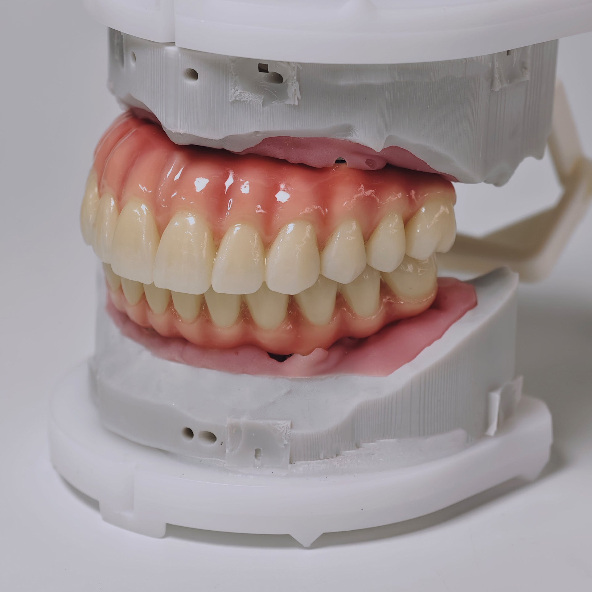 Zirconia-Enamel Hybrid Malo Bridge