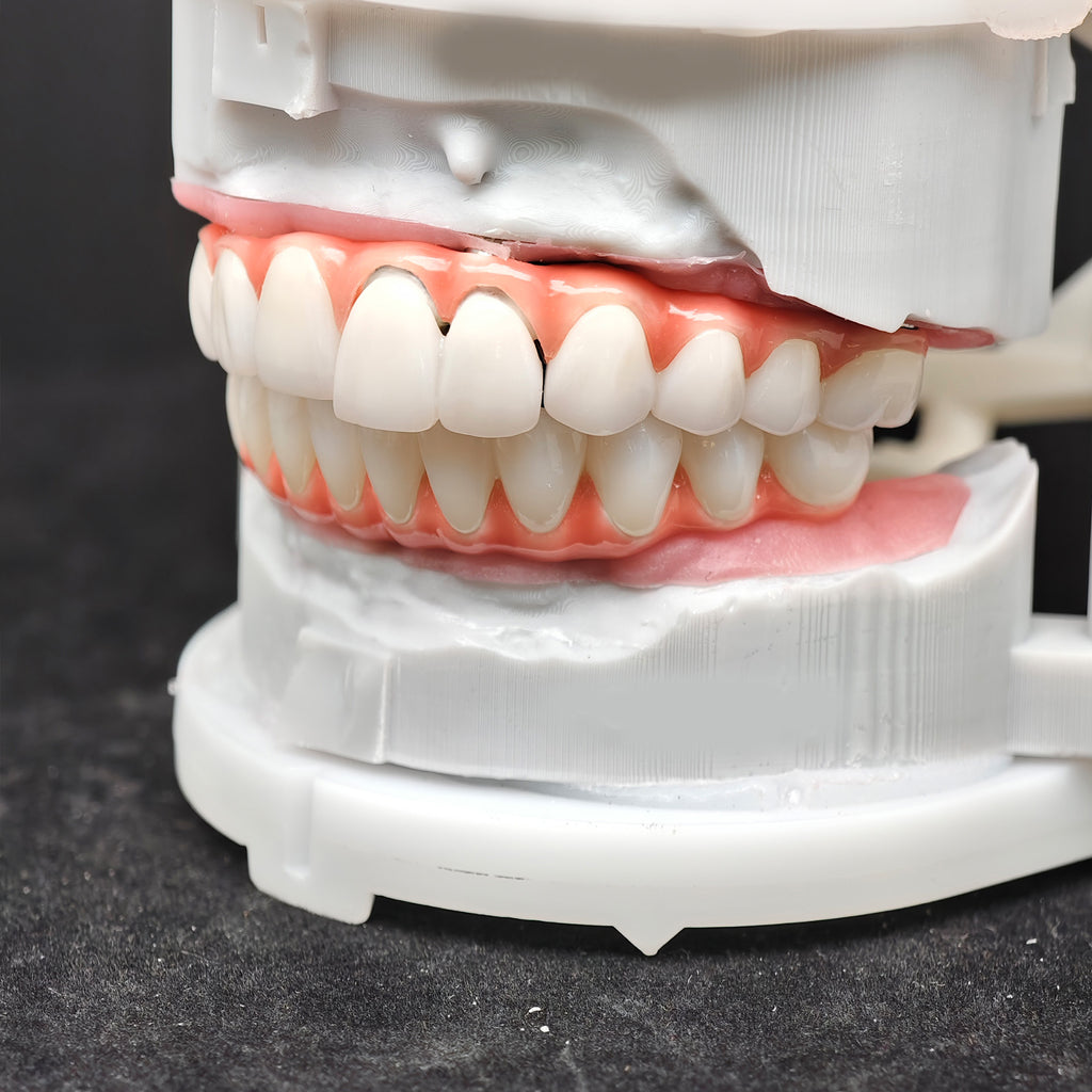 Zirconia-Enamel Hybrid Malo Bridge