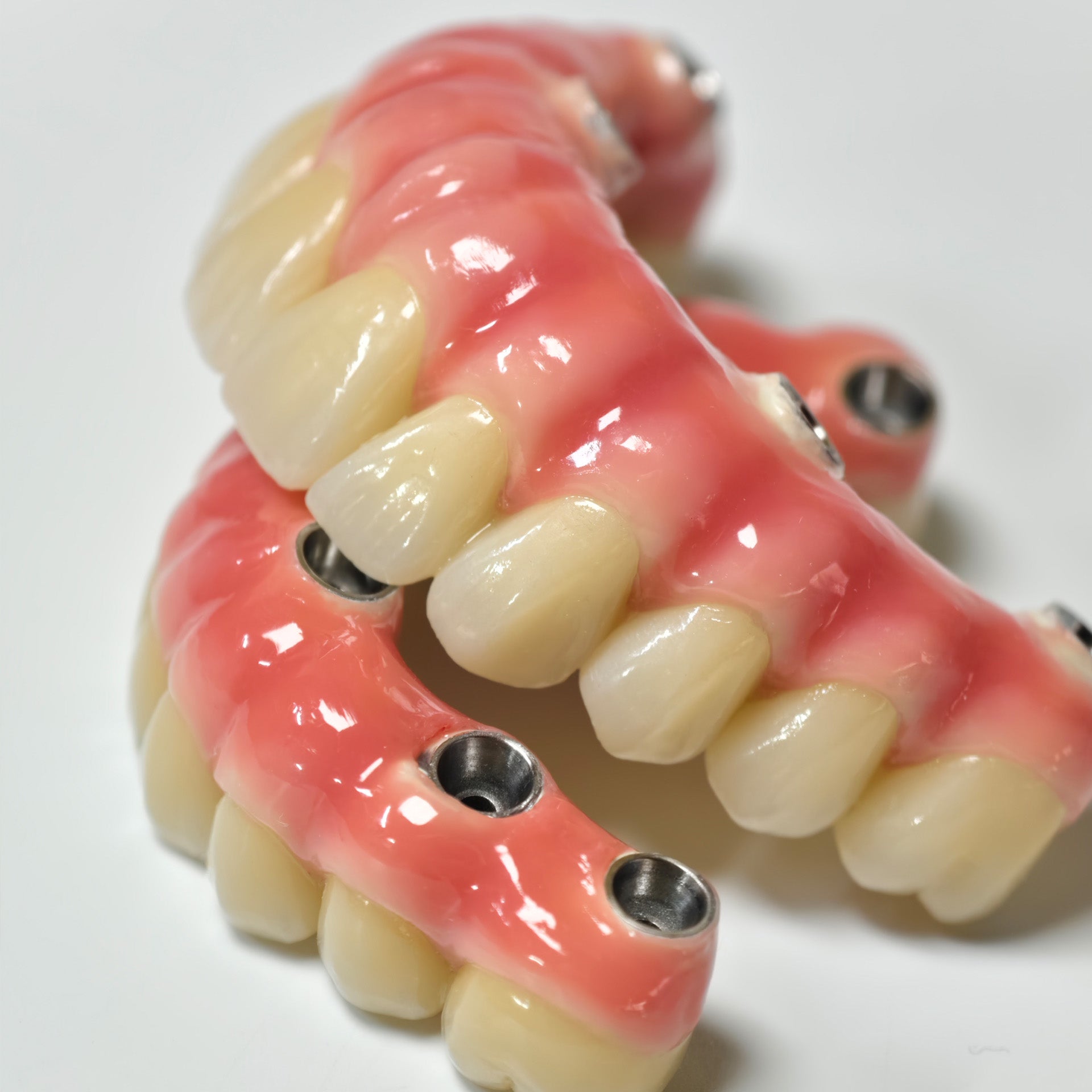 Zirconia-Enamel Hybrid Malo Bridge