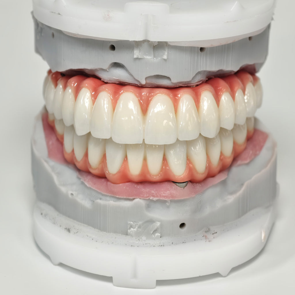 Zirconia-Enamel Hybrid Malo Bridge