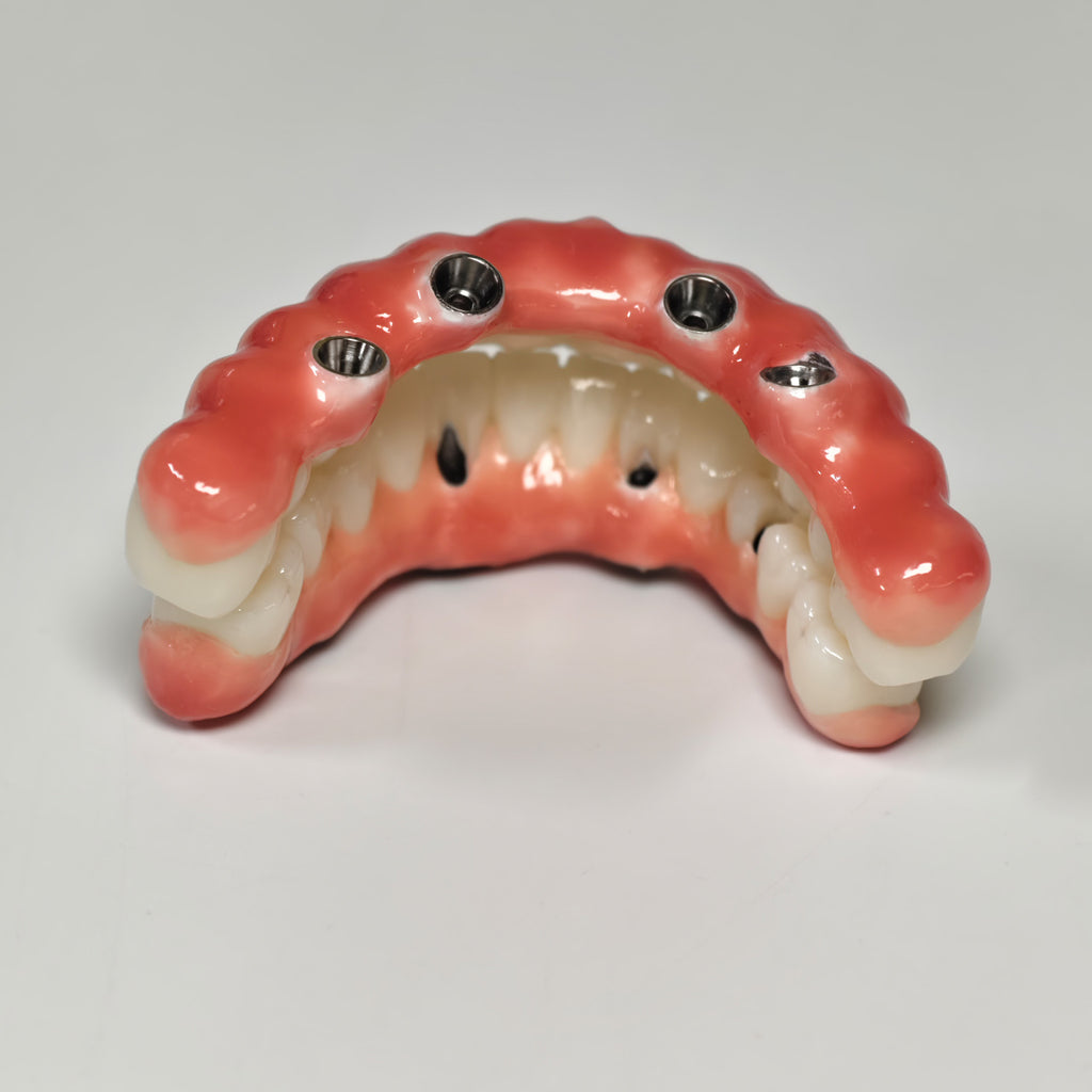 Zirconia-Enamel Hybrid Malo Bridge