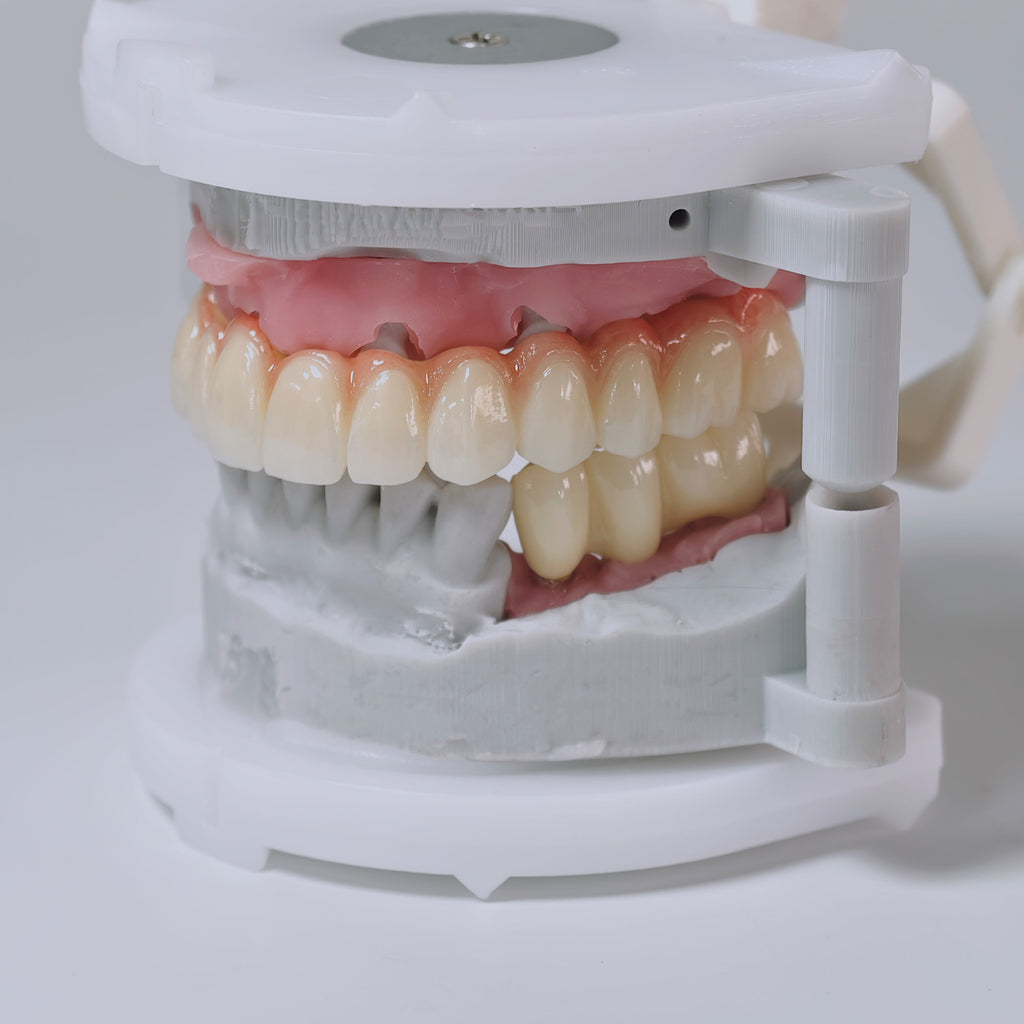 Zirconia Implant Bridges Screwmentable Dental Crown
