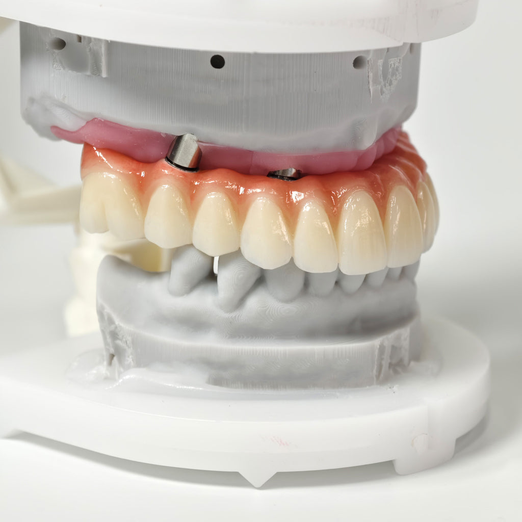 All On 5 Zirconia Bridge With Ti-Base Screw Retained
