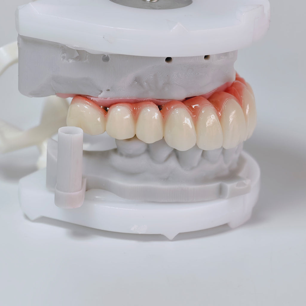 All On 6 Zirconia Bridge With Ti-Base Screw Retained