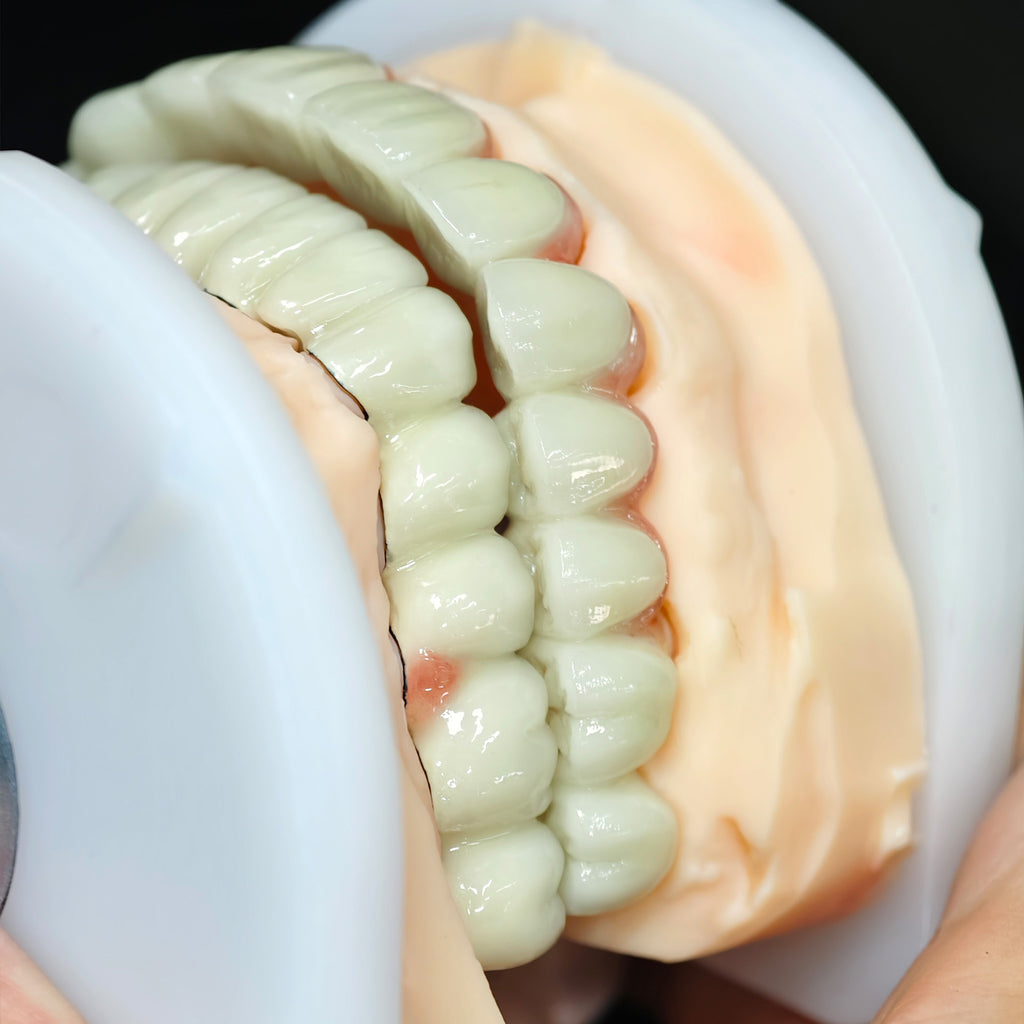 Co - Cr PFM Dental Bridge