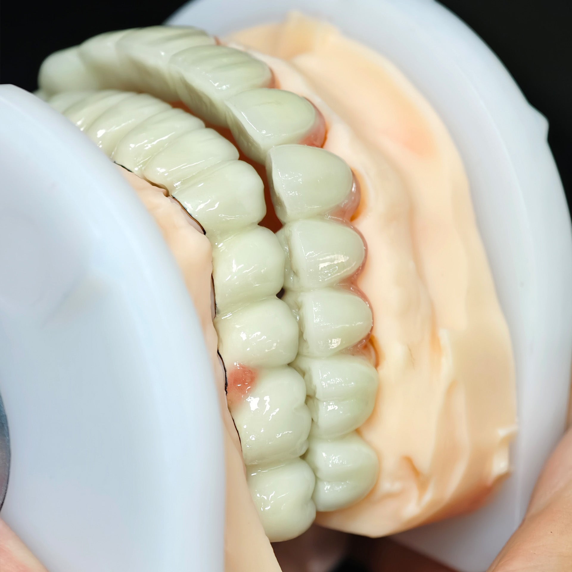 Co - Cr PFM Dental Bridge