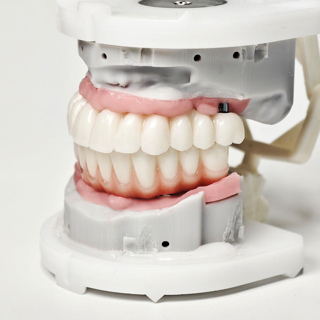 Full-Arch Zirconia Bridge With Ti-Base Abutment