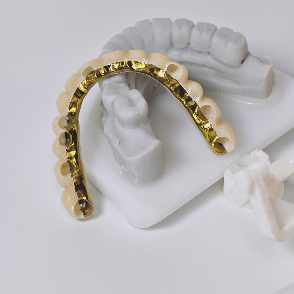 Ti-Bar Titanium Nitride Metal Frame With Zirconia Bridge And Cement Retained
