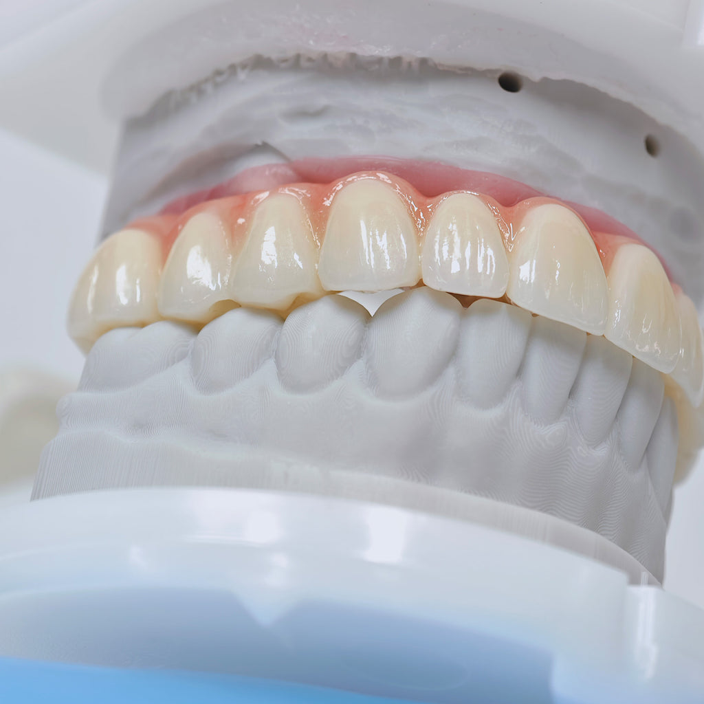 Ti-Bar Titanium Nitride Metal Frame With Zirconia Bridge For Full Arch Restoration