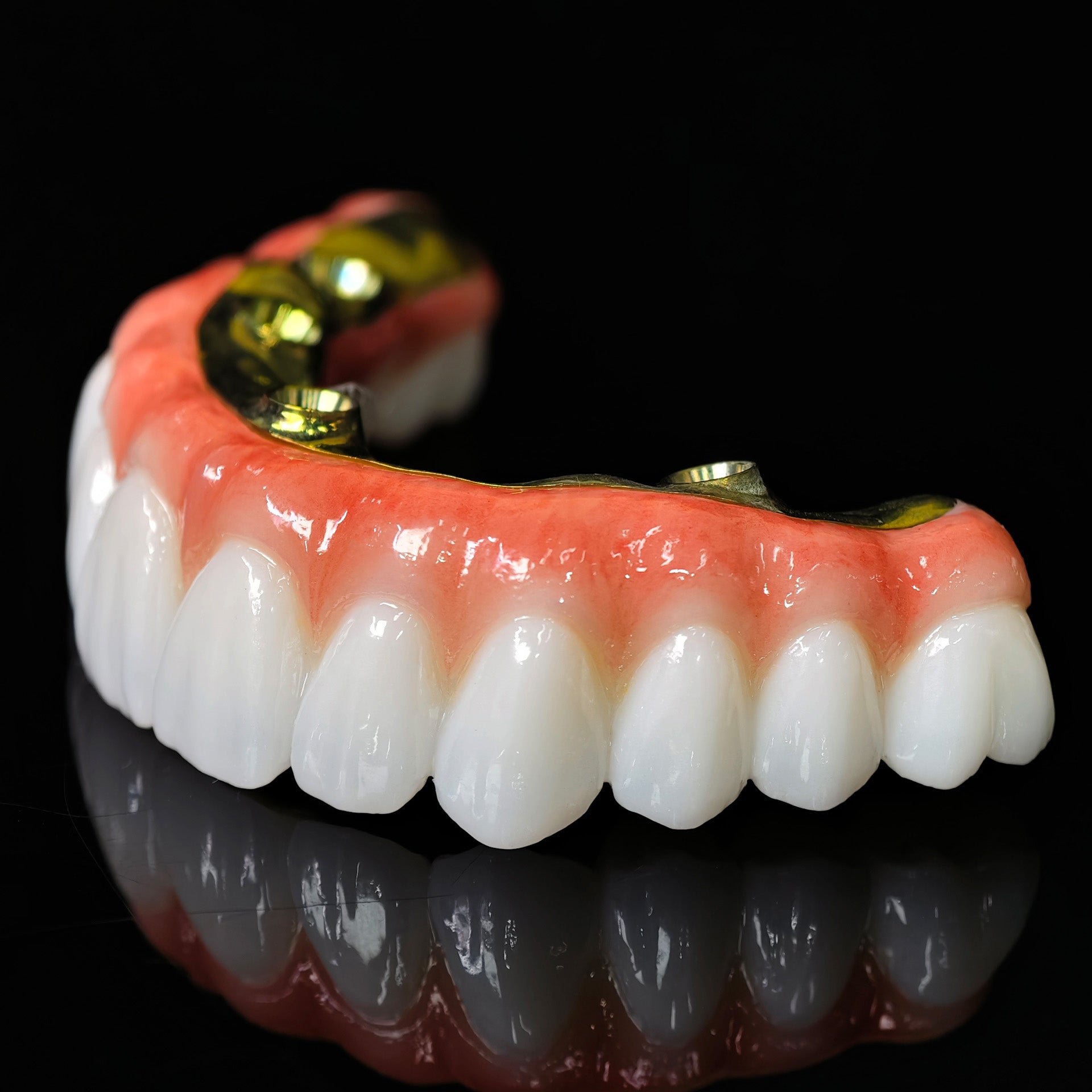 Ti-Bar Titanium Nitride Metal Frame With Zirconia Bridge For Full Arch Restoration
