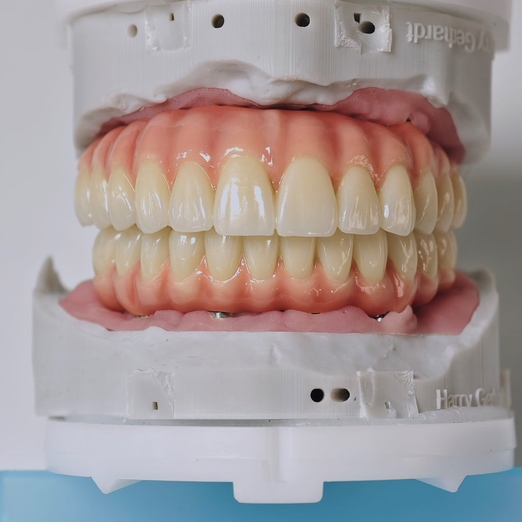 Zirconia-Enamel Hybrid Malo Bridge