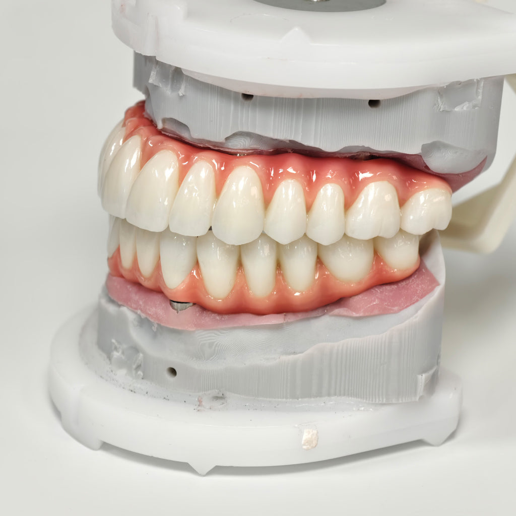 Zirconia-Enamel Hybrid Malo Bridge