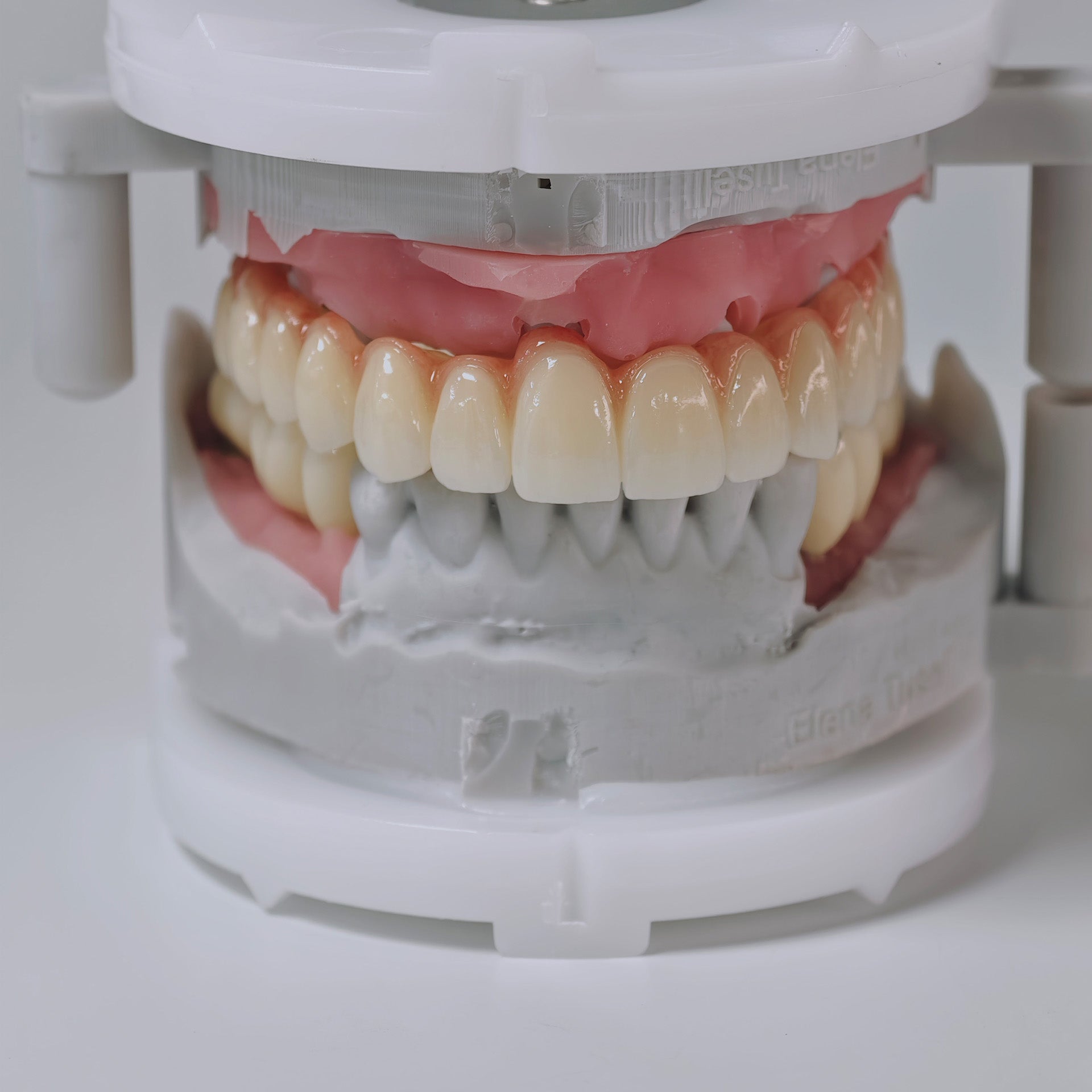 Zirconia Implant Bridges Screwmentable Dental Crown