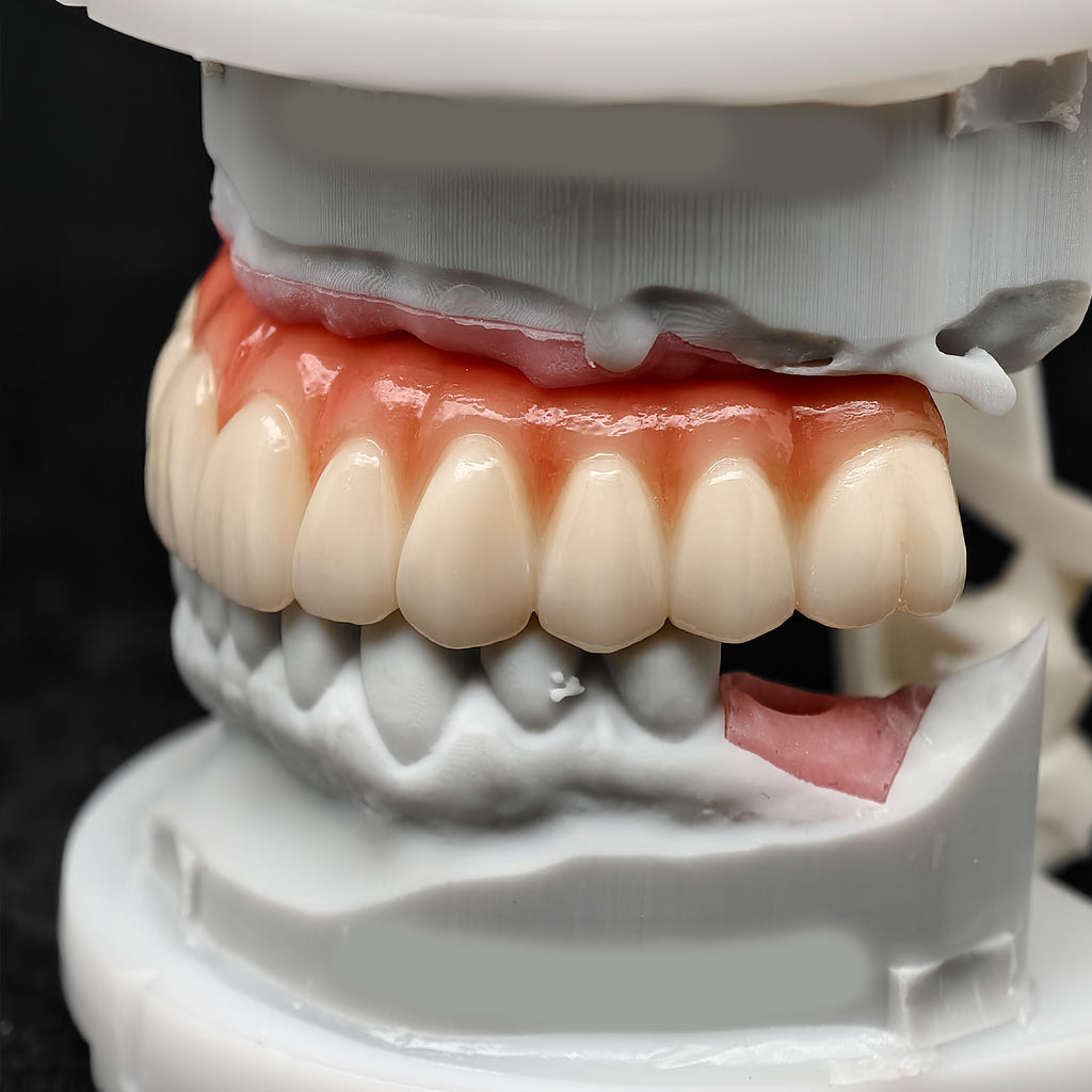 All On 4 Zirconia Bridge With Ti-Base Screw Retained Trying For Full Arch Restoration