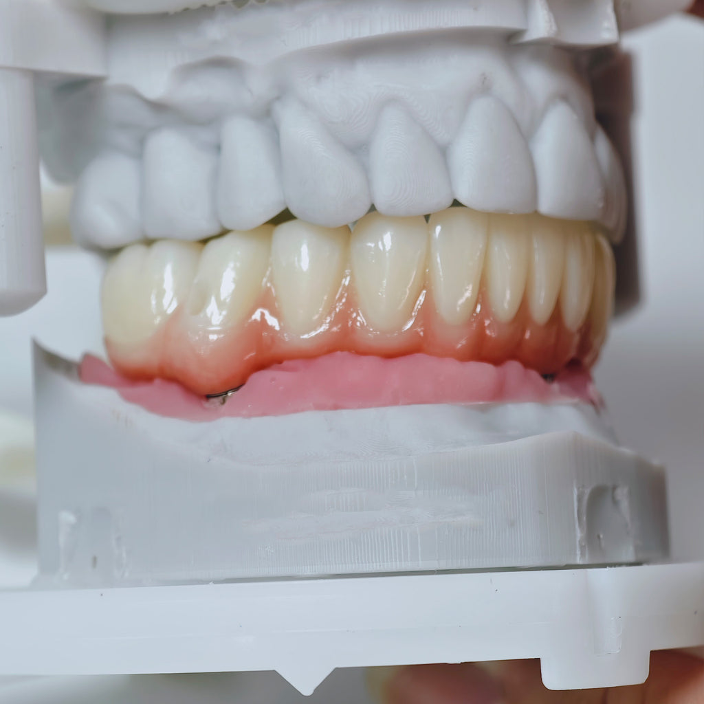 All On 4 Zirconia Bridge With Ti-Base Screw Retained