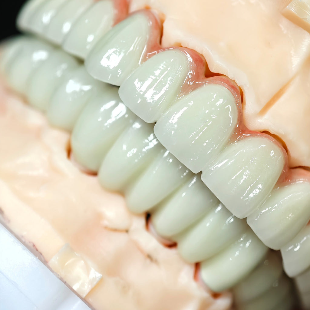 Co - Cr PFM Dental Bridge