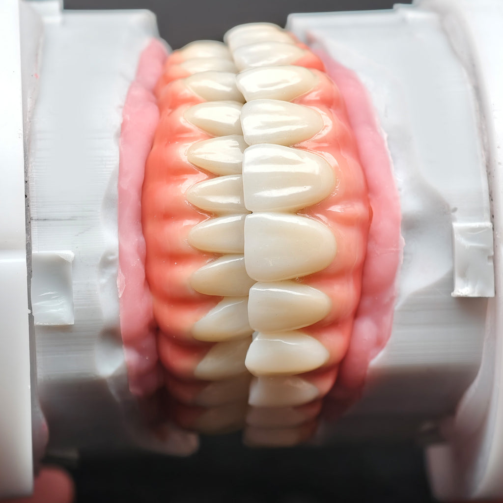 Enhanced Zirconia Crown Malo Bridge