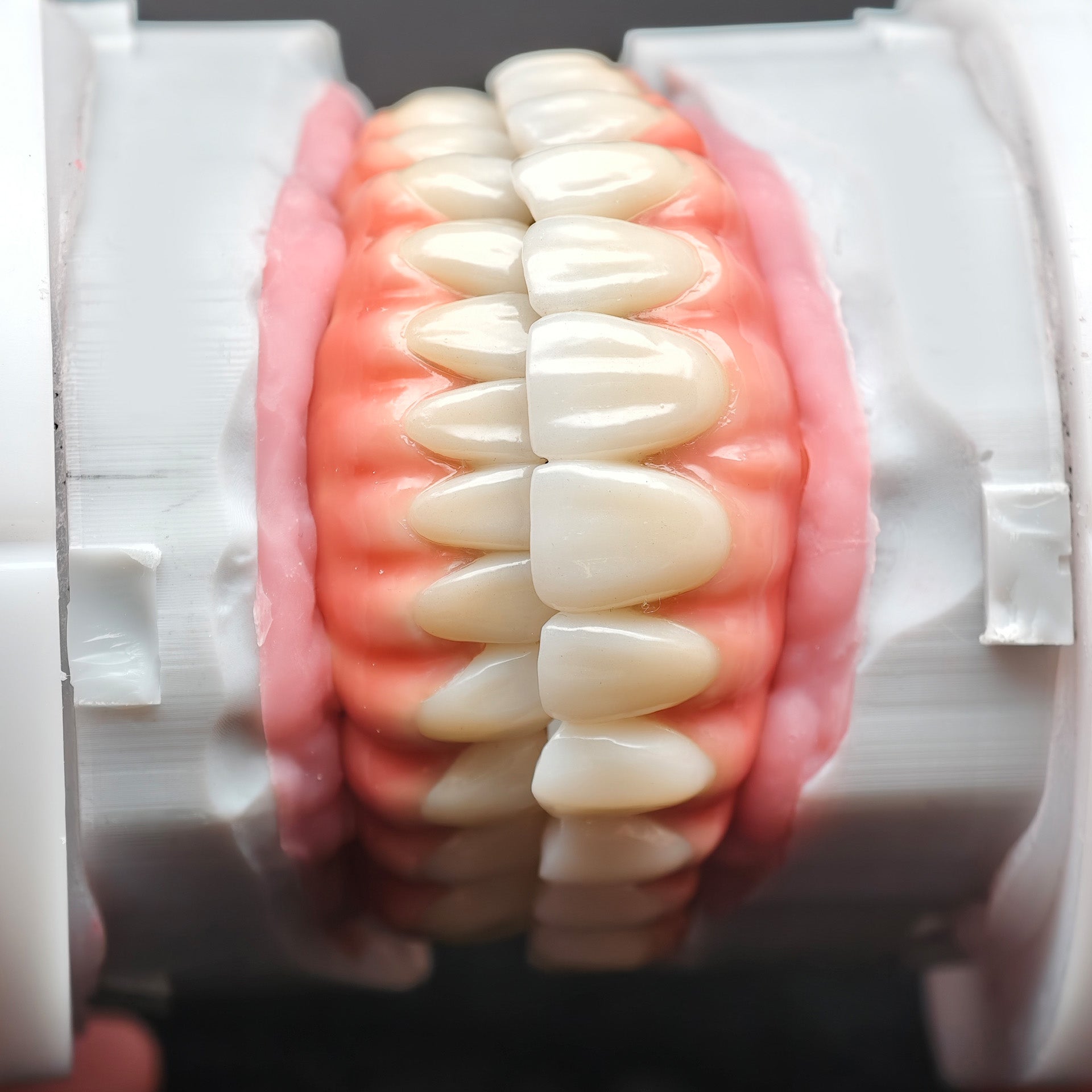 Enhanced Zirconia Crown Malo Bridge