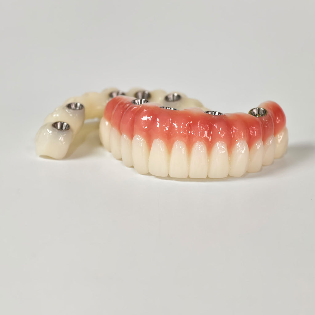 Full-Arch PMMA Bridge With Ti-Base Screw Retained