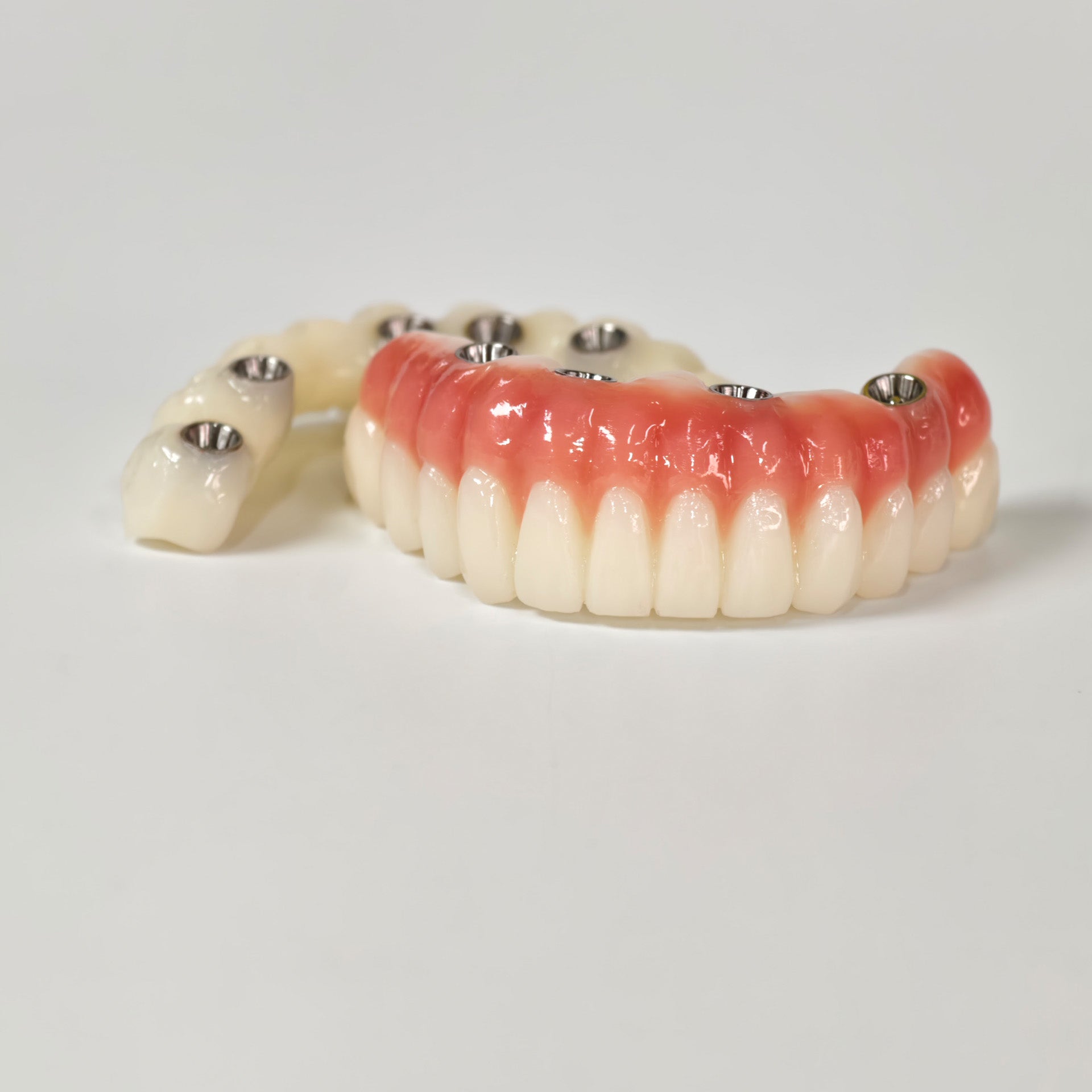 Full-Arch PMMA Bridge With Ti-Base Screw Retained
