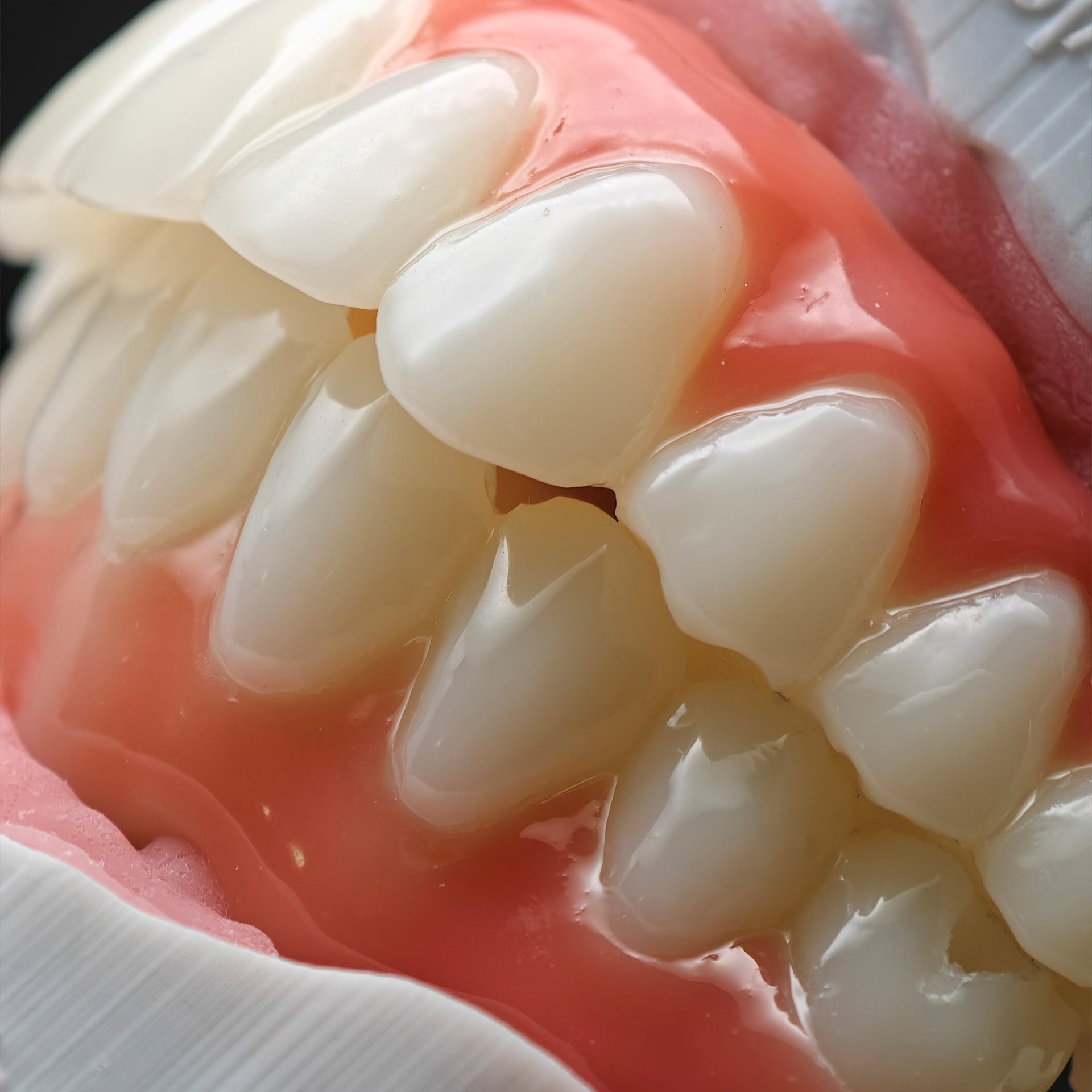 PMMA Bridge With Ti-Base Screw Retained Trying For Full Arch Restoration