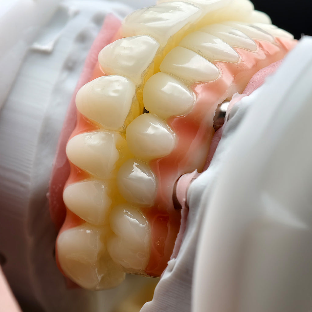 PMMA Bridge With Ti-Base Screw Retained Trying For Full Arch Restoration
