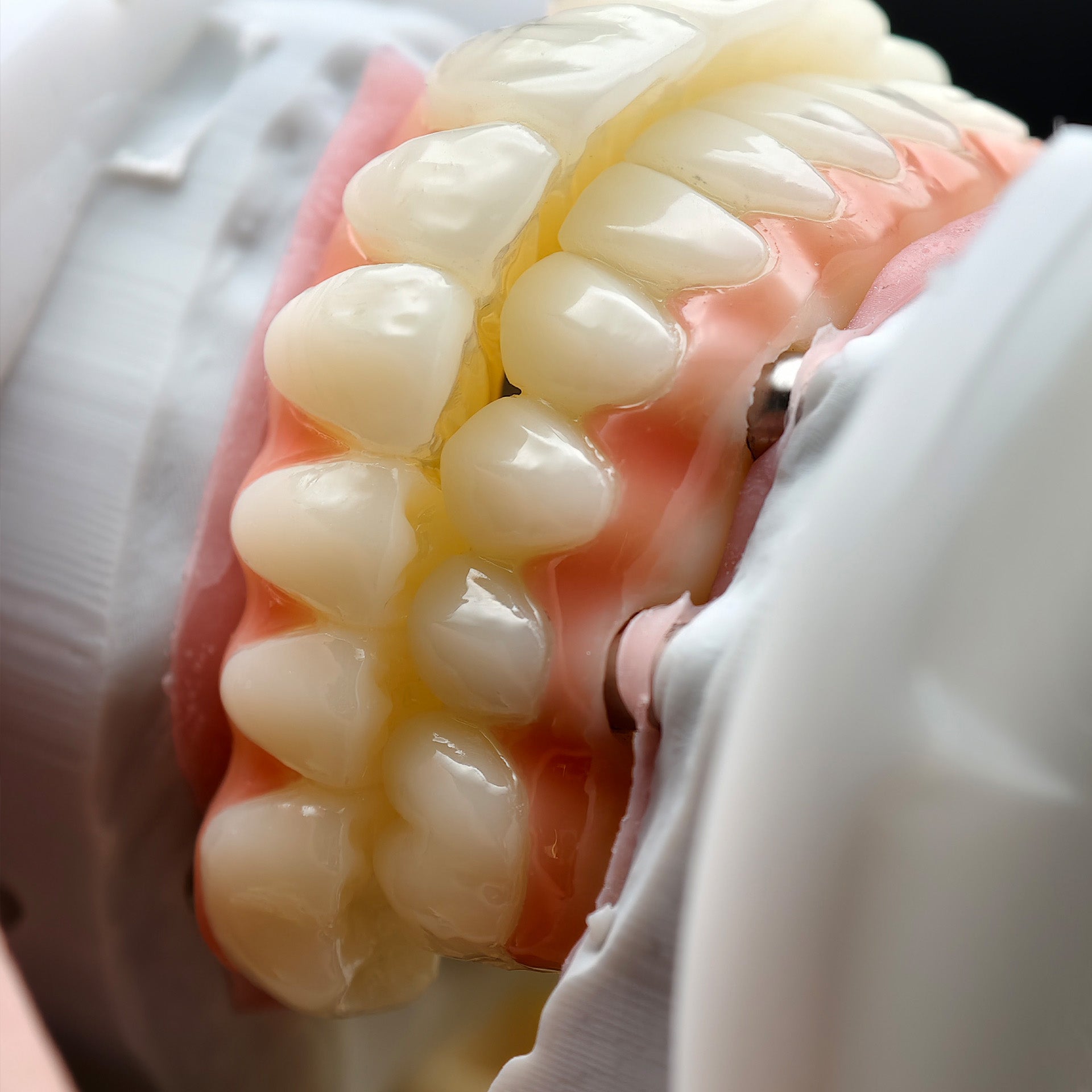PMMA Bridge With Ti-Base Screw Retained Trying For Full Arch Restoration