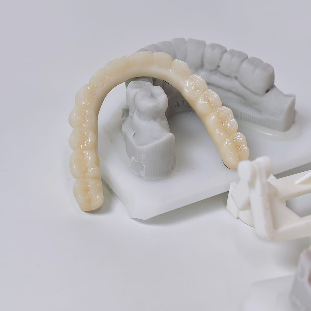 Ti-Bar Titanium Nitride Metal Frame With Zirconia Bridge And Cement Retained