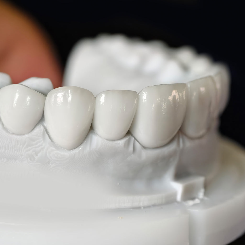 Ultra-Thin Emax Veneer. High Transparency/Translucent, Natural Shade