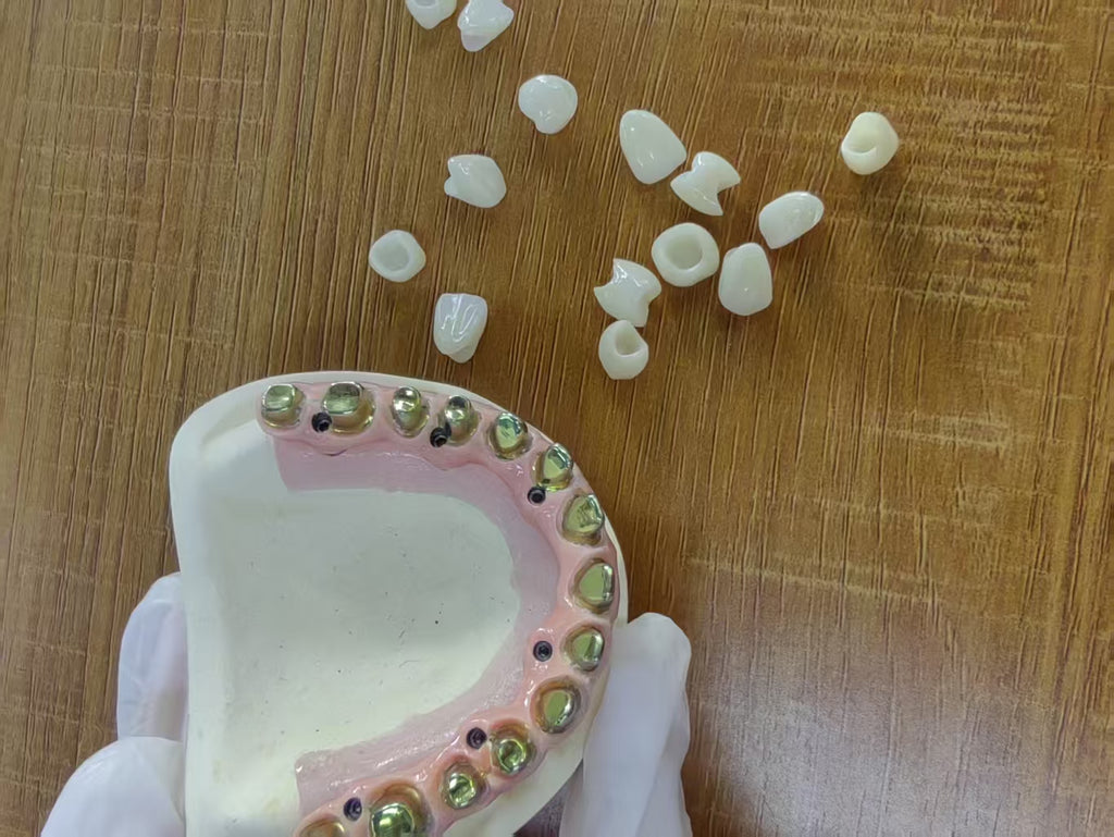 Malo Bridge Pure Titanium Metal Frame Full Arch Restoration Dental Lab In China