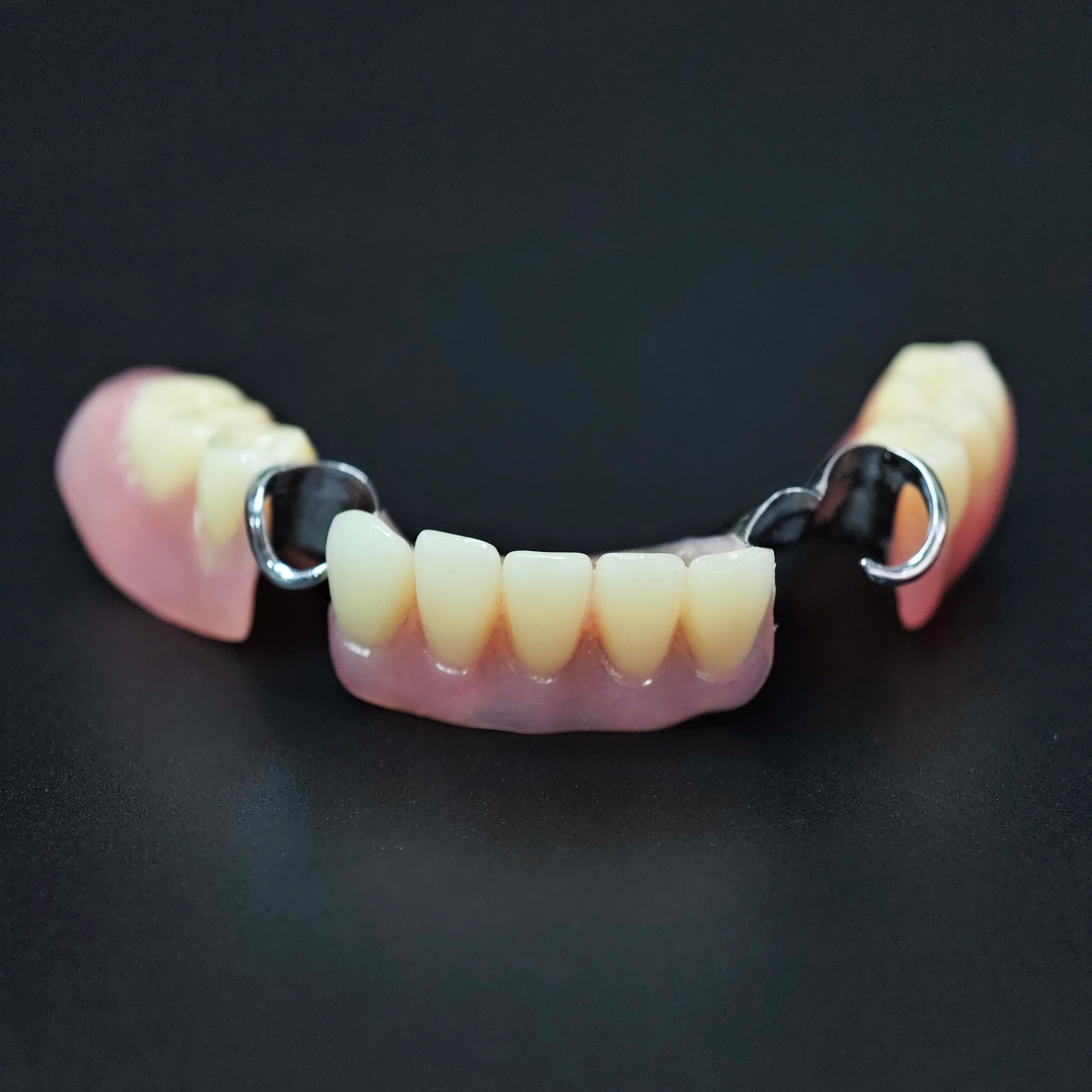 Cobalt Chrome Framework Denture Metal Framework With Acrylic Denture