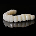 Full Arch Restoration For Temp Bridge Pmma Bridge