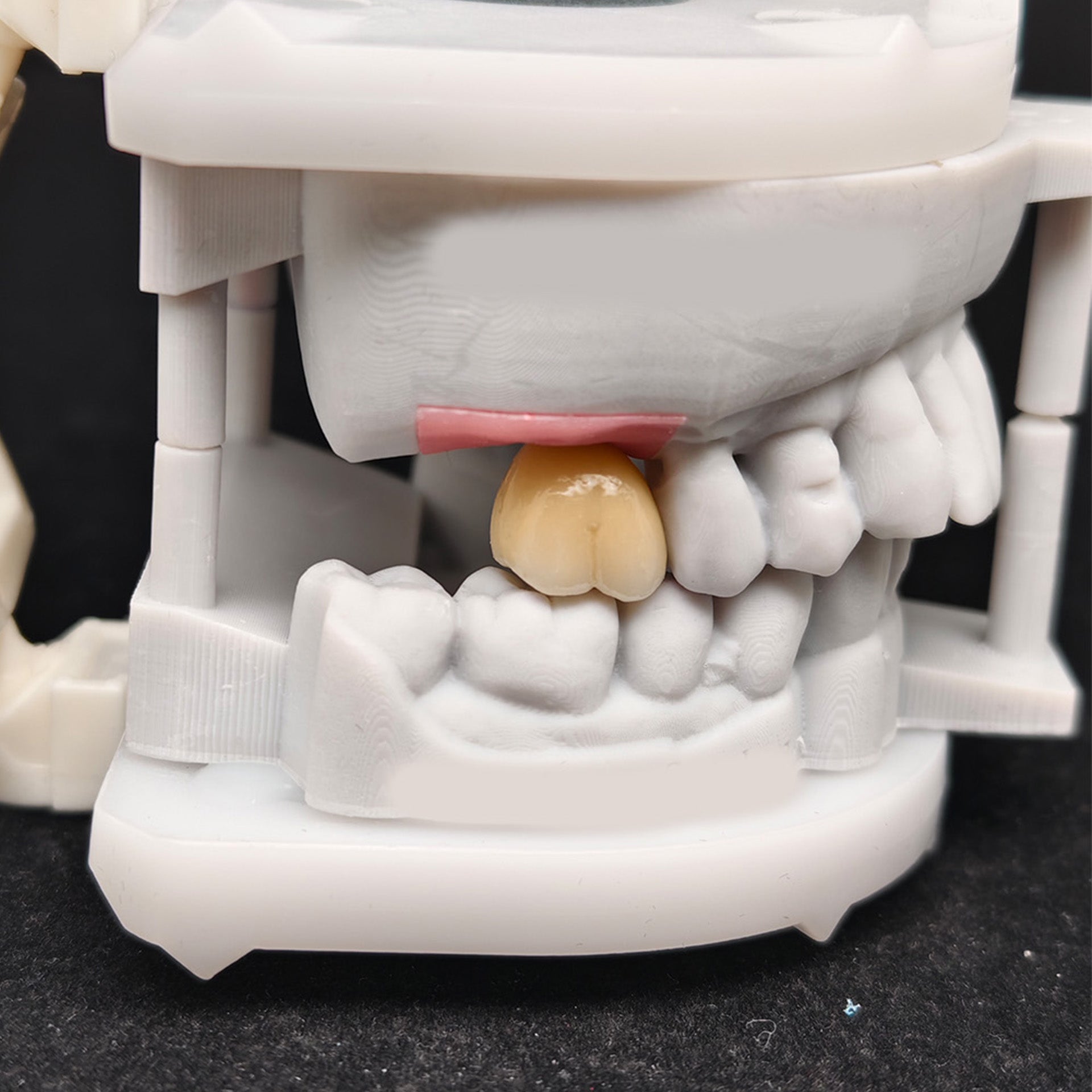 Custom Zirconia Implant Crown And Bridge