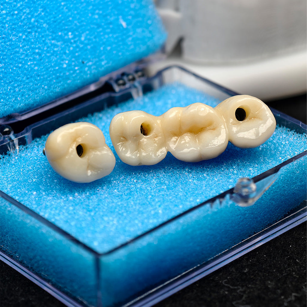 Custom Zirconia Implant Crown And Bridge