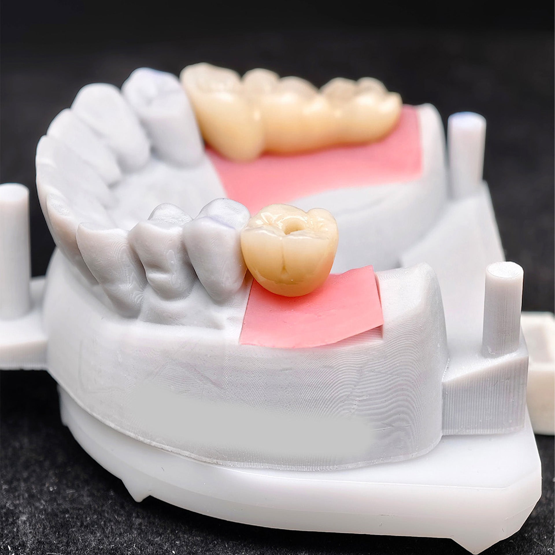 Custom Zirconia Implant Crown And Bridge