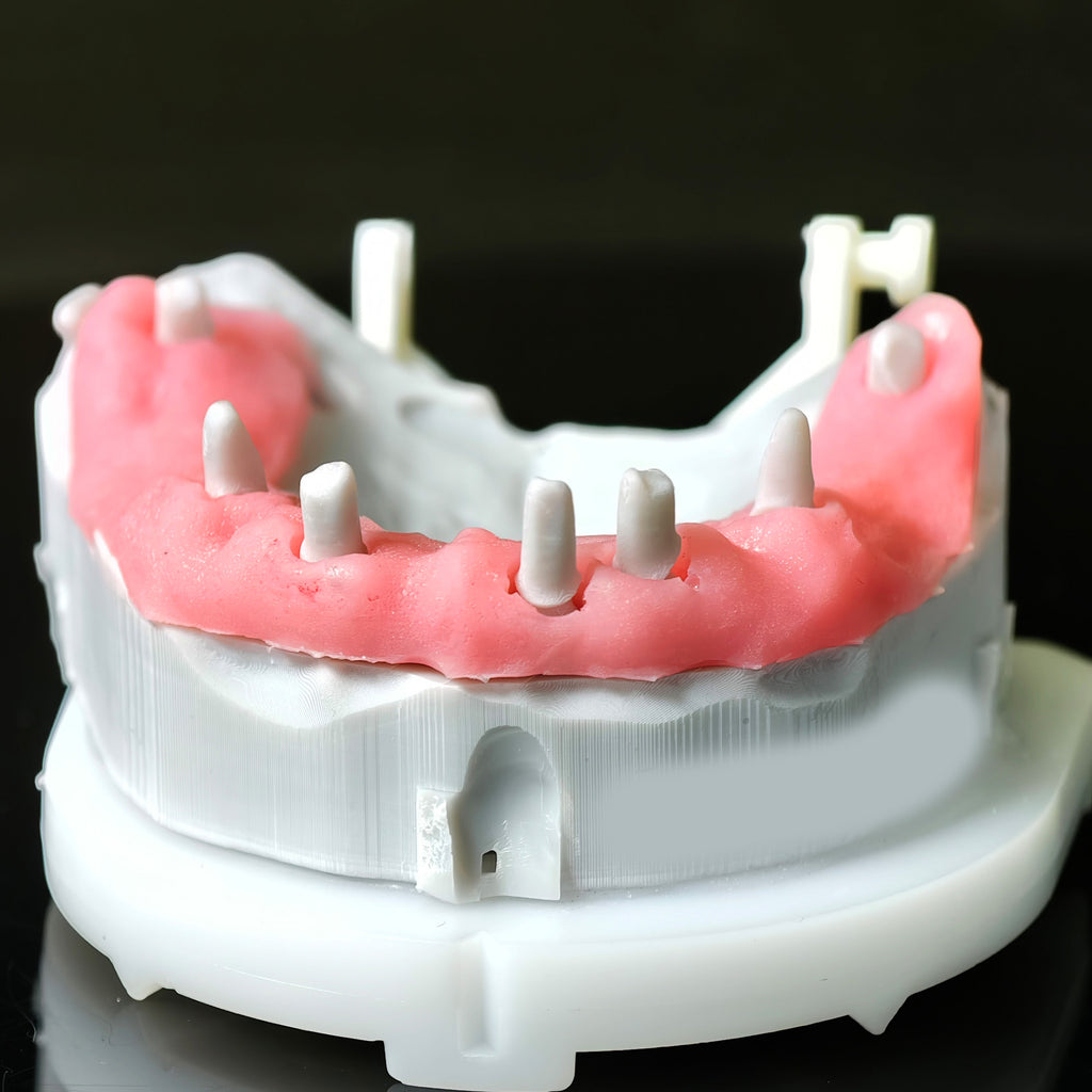 Full Arch Restoration For Temp Bridge Pmma Bridge