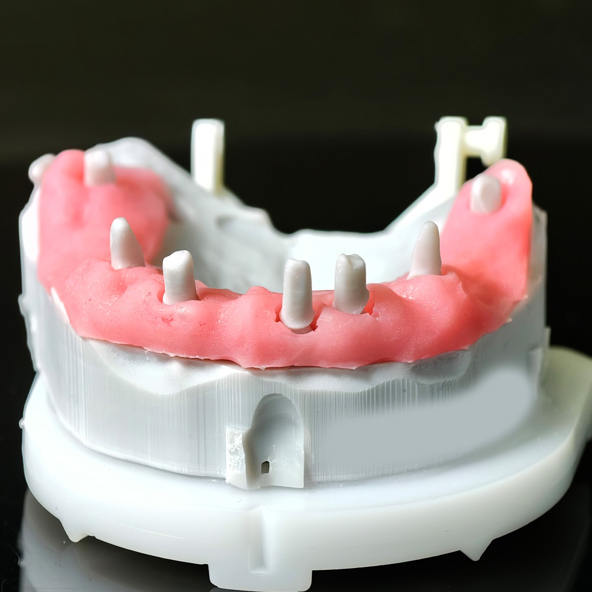 Full Arch Restoration For Temp Bridge Pmma Bridge