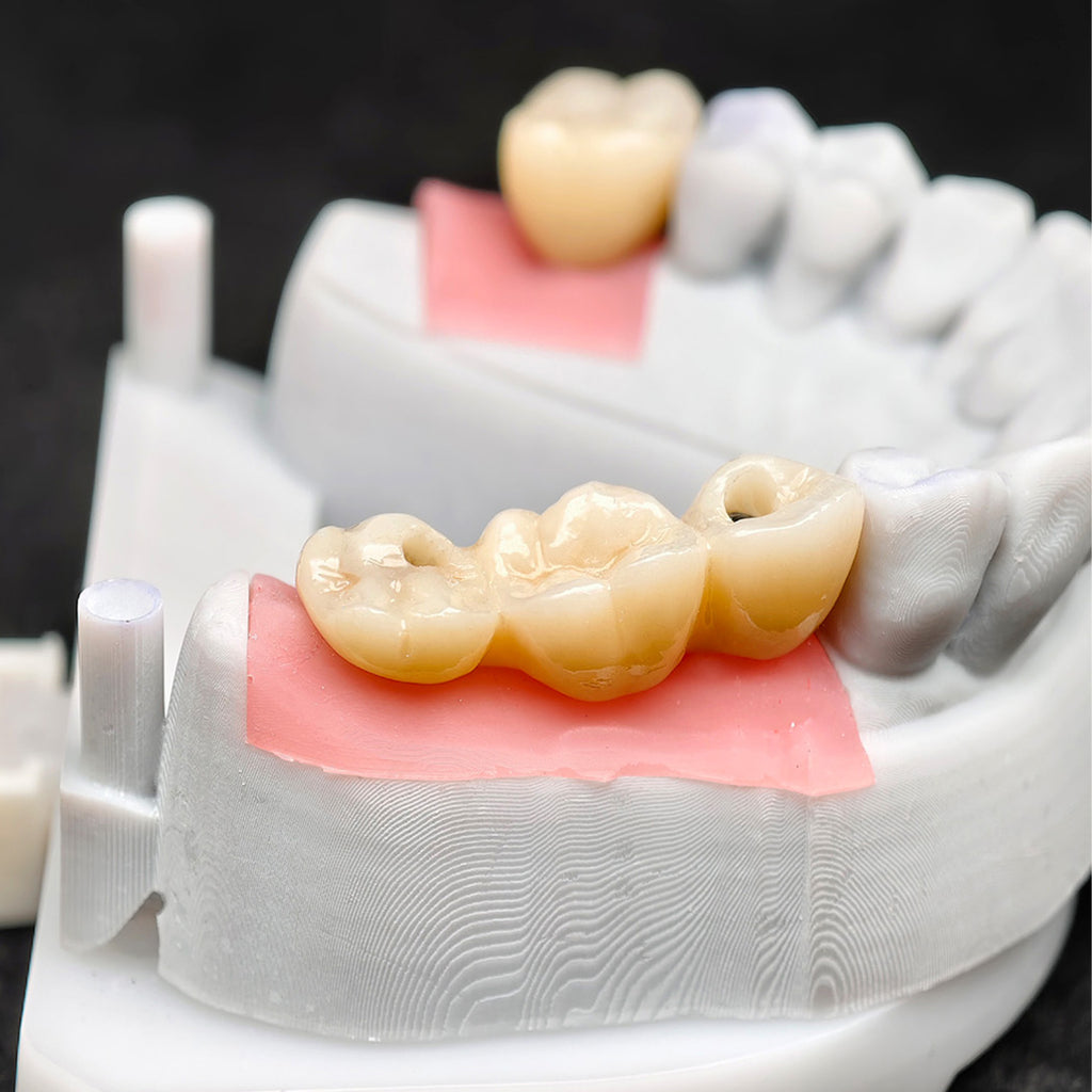 Custom Zirconia Implant Crown And Bridge