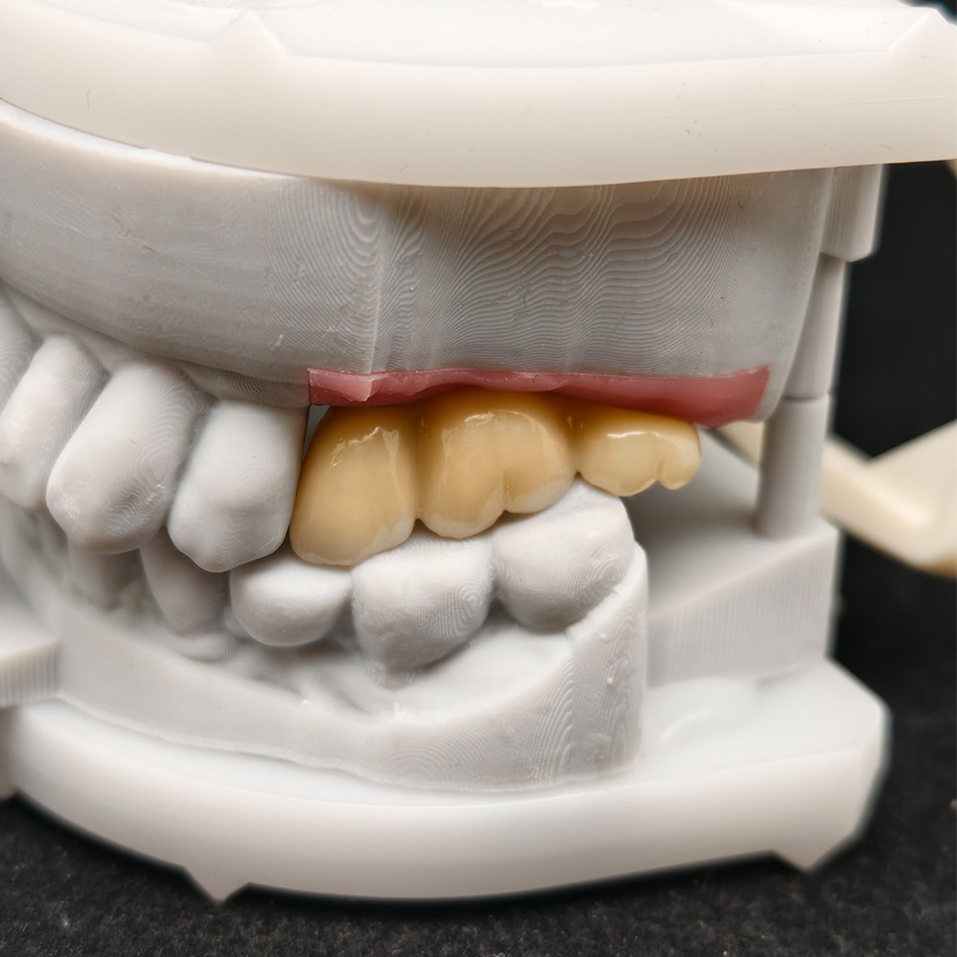 Custom Zirconia Implant Crown And Bridge