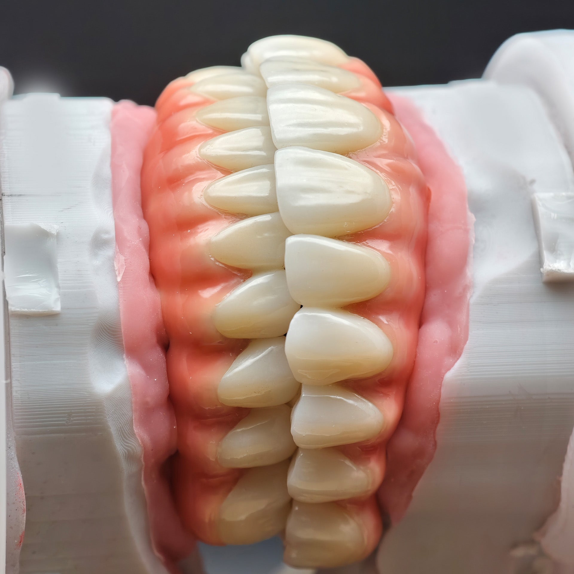 Enhanced Zirconia Crown Malo Bridge