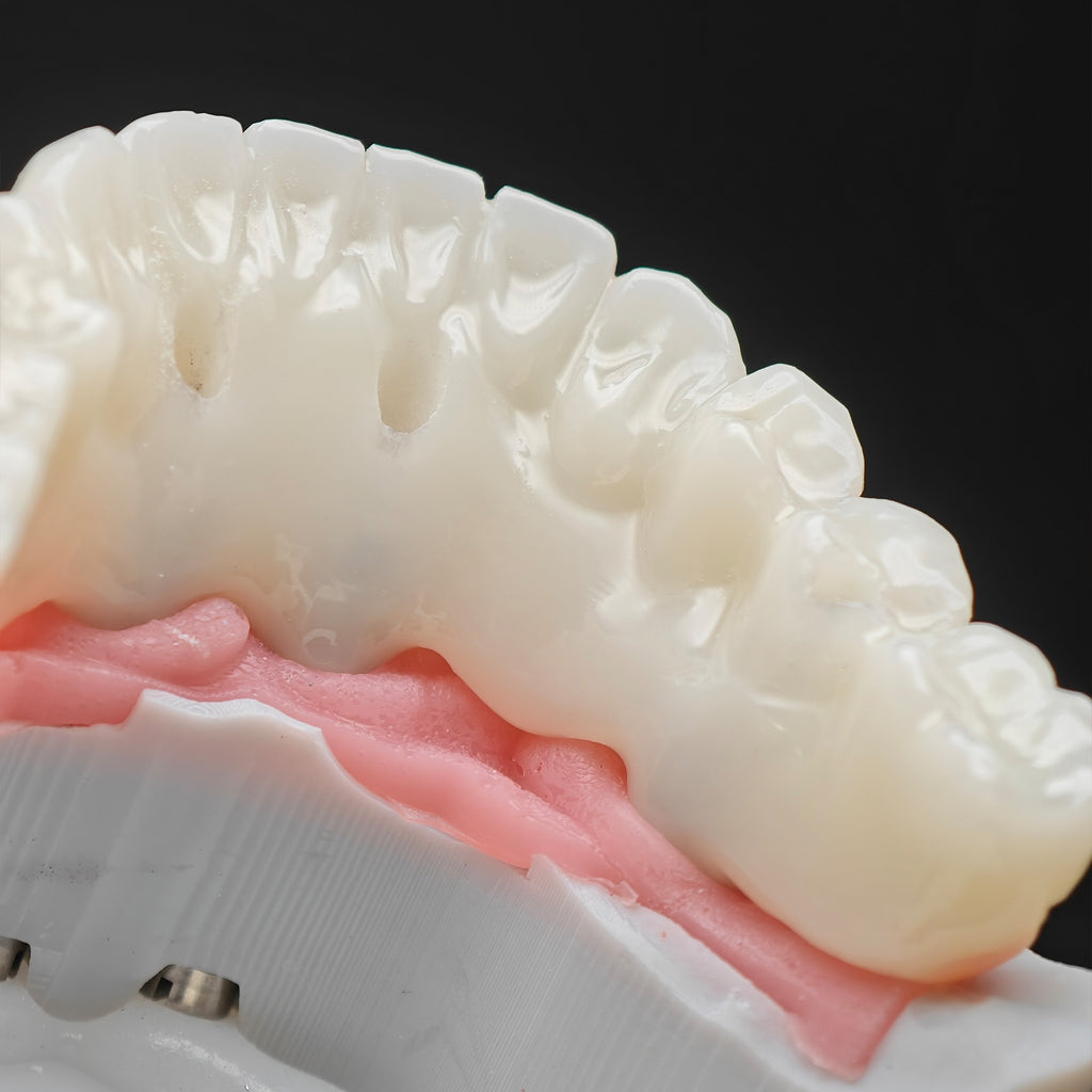 PMMA Bridge With Ti-Base Screw Retained Trying For Full Arch Restoration