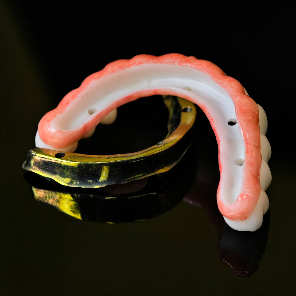 Ti-Bar Titanium Nitride Metal Frame With Zirconia Bridge For Full Arch Restoration