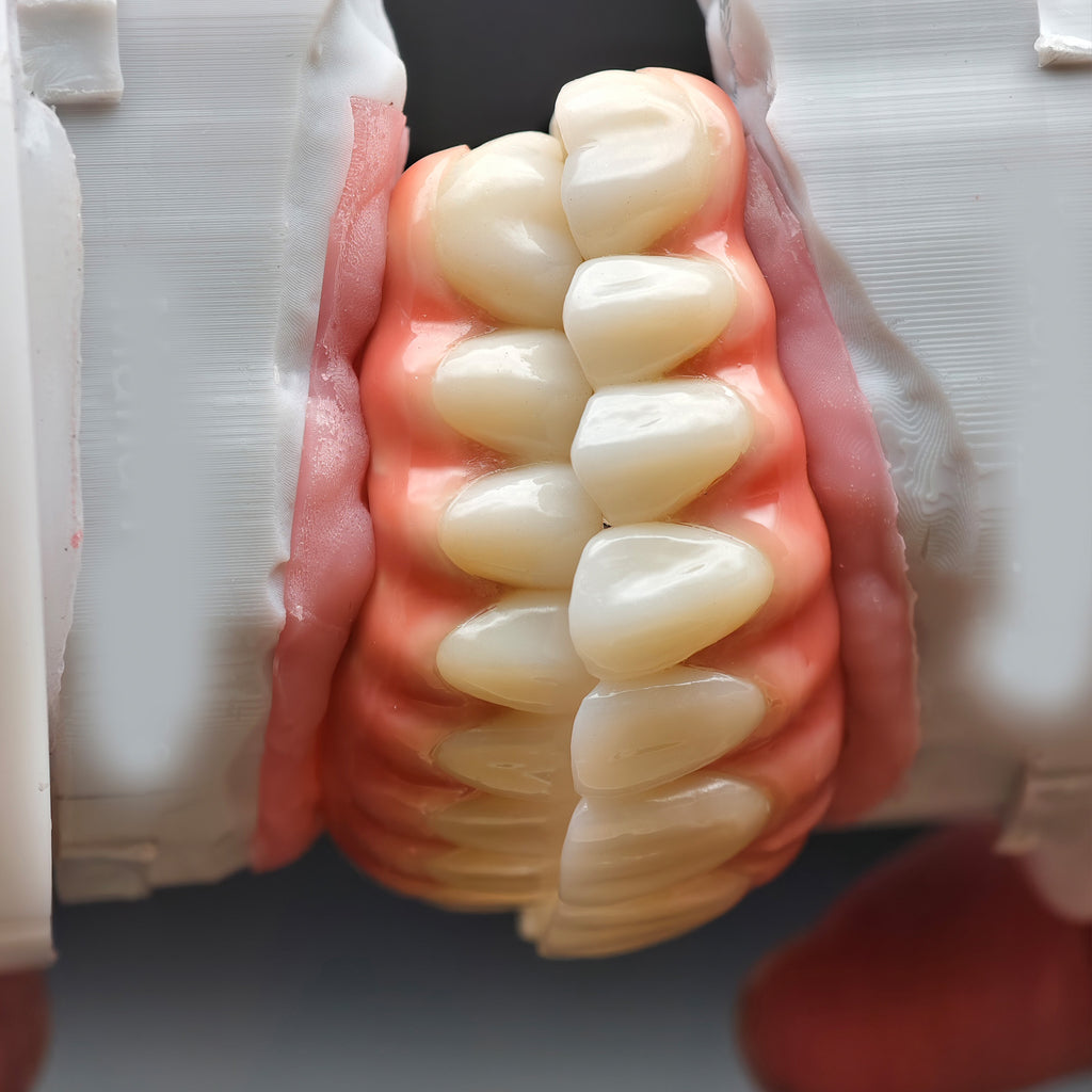Enhanced Zirconia Crown Malo Bridge